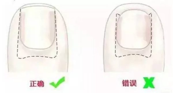 为5分钟彩官方下载常用功能光线太强也