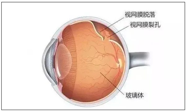 延伸阅读
