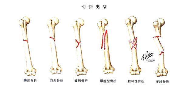 主要目的之一是